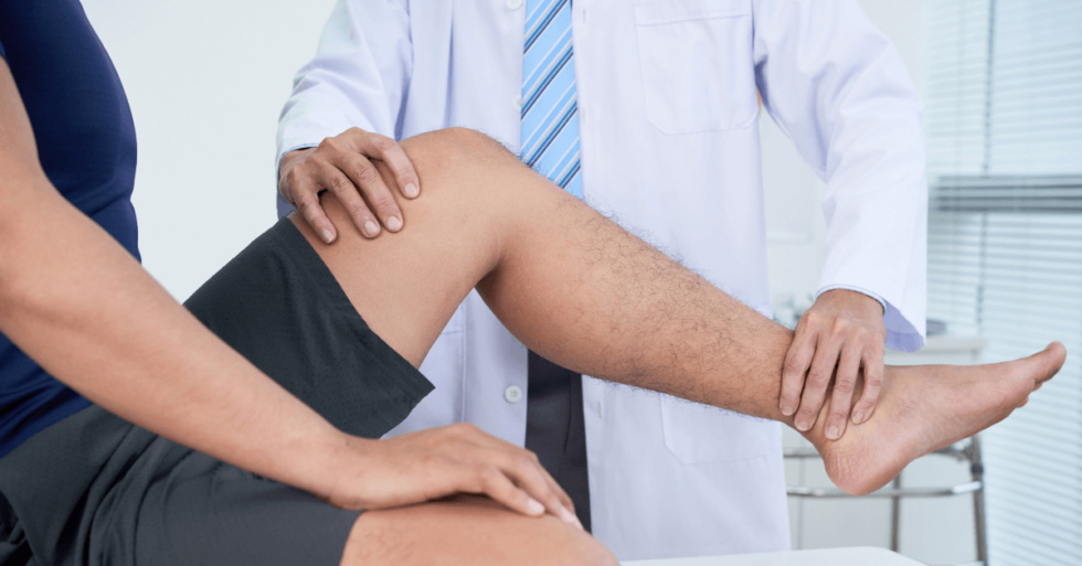 home remedies for varicose and spider veins